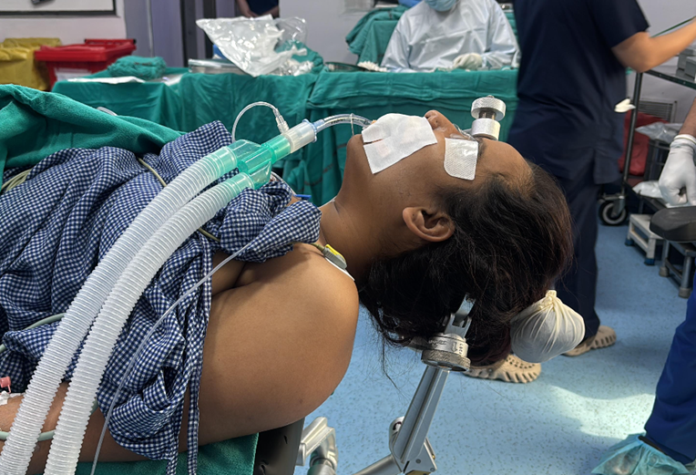 Figure 4. Patient positioning for left pterional craniotomy- extended and rotated slightly to the opposite side